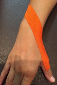 インターセクション症候群テーピング