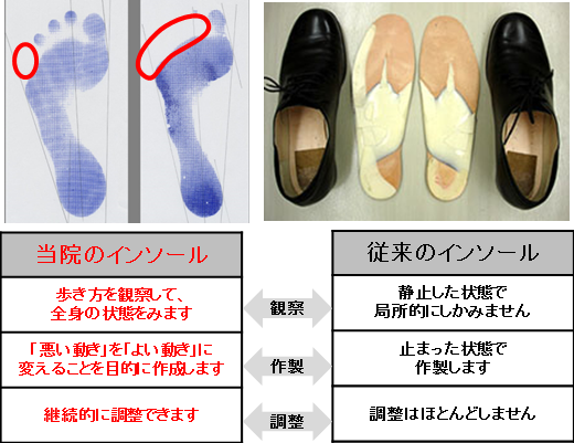 当院のインソールと従来のインソールとの違い
