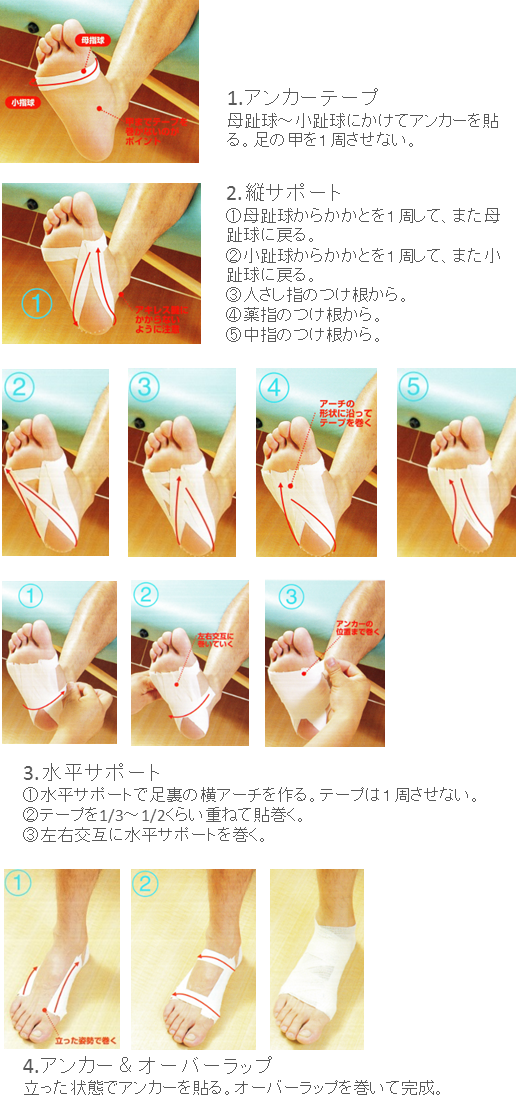 足底腱膜の保護テーピング