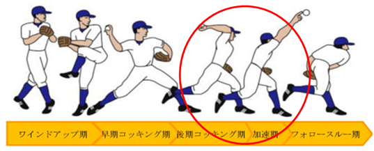 野球肘の痛いフェーズ