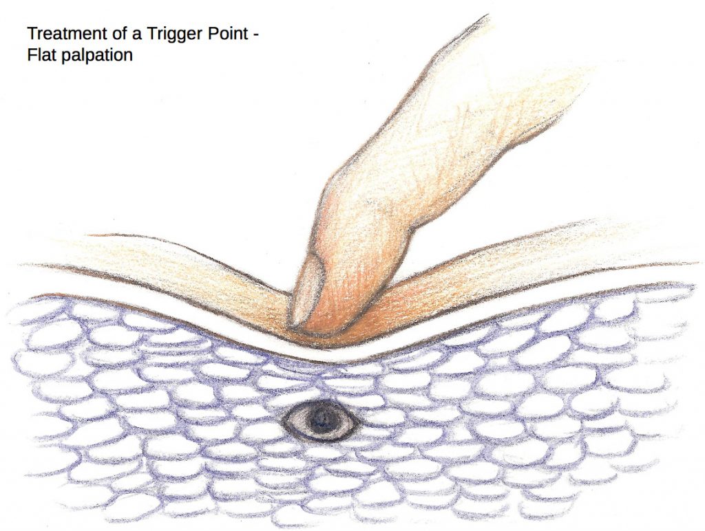 trigger-point-palpation-1024x772