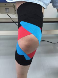 膝関節後外側不安定性に対するテーピング