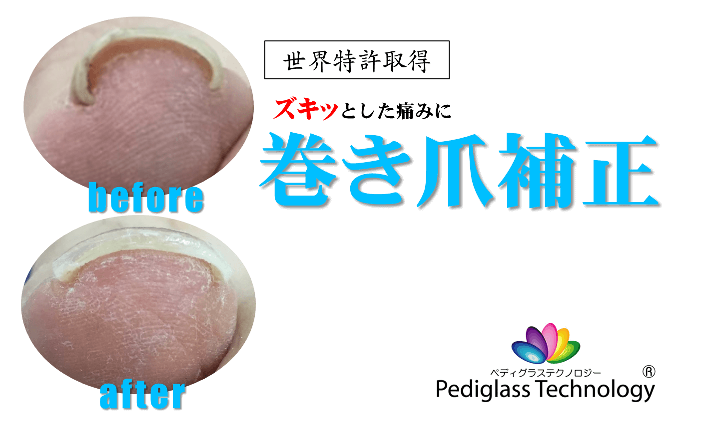 金沢市アルコット接骨院 インソール工房併設