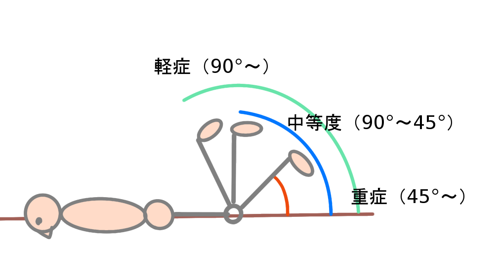 大腿四頭筋の肉ばなれ