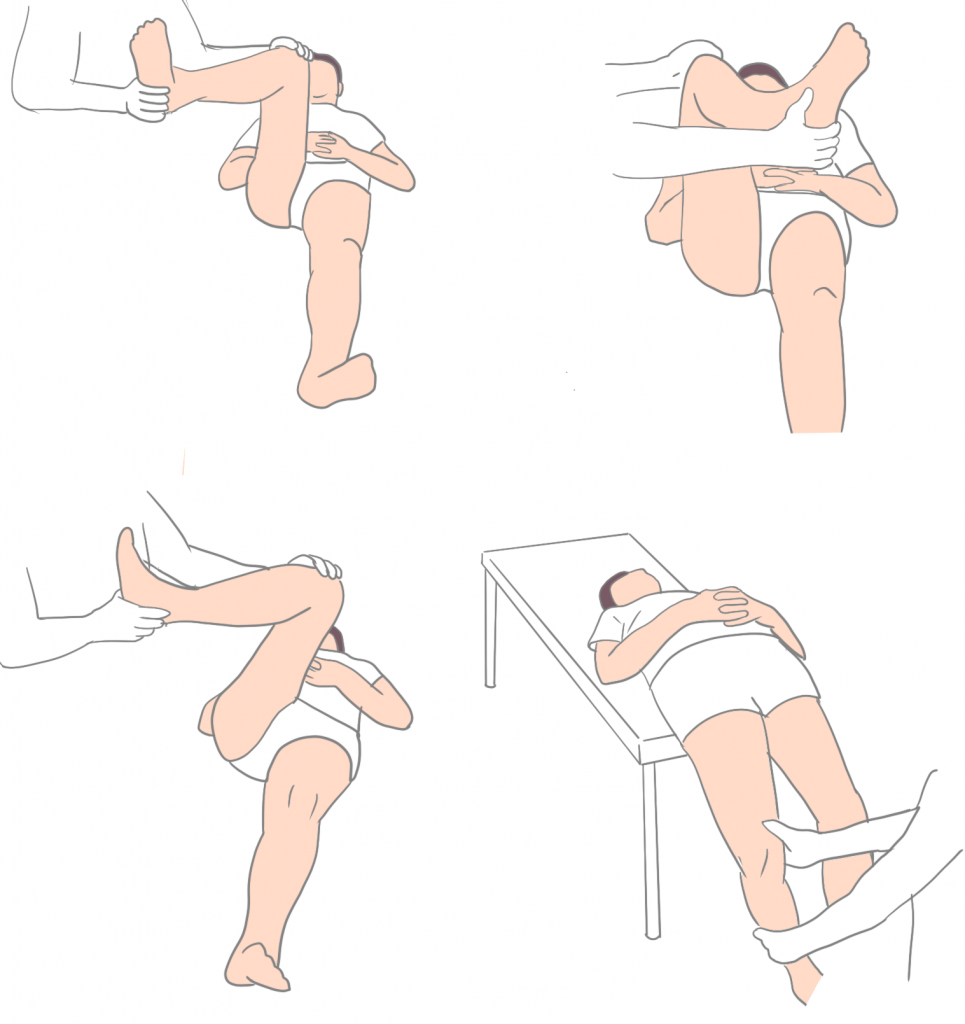 股関節の検査画像