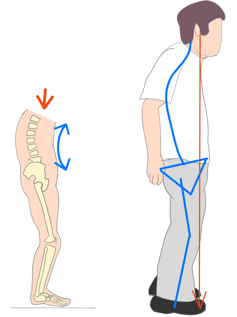 変形性腰椎症の姿勢