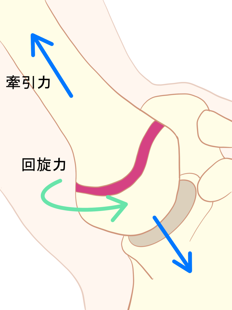 リトルリーガーズショルダー原因