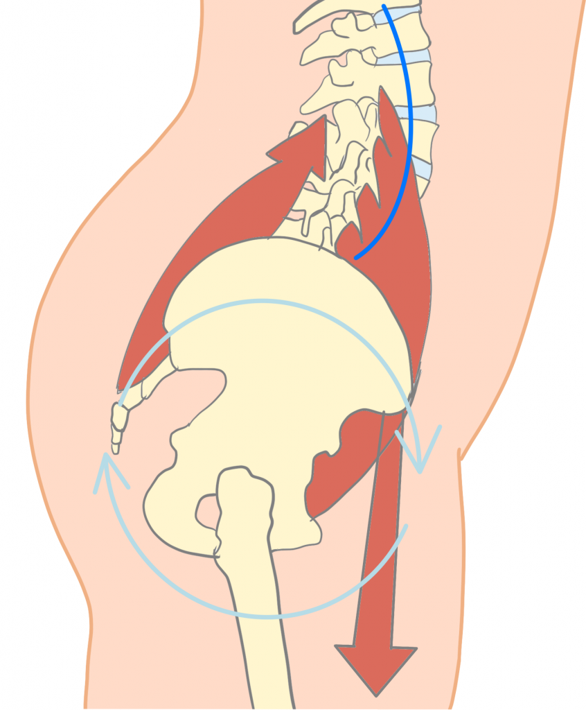 腸腰筋による腰椎過前弯