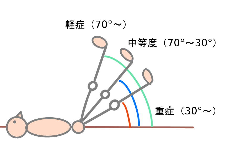 ハムストリングスの肉ばなれ