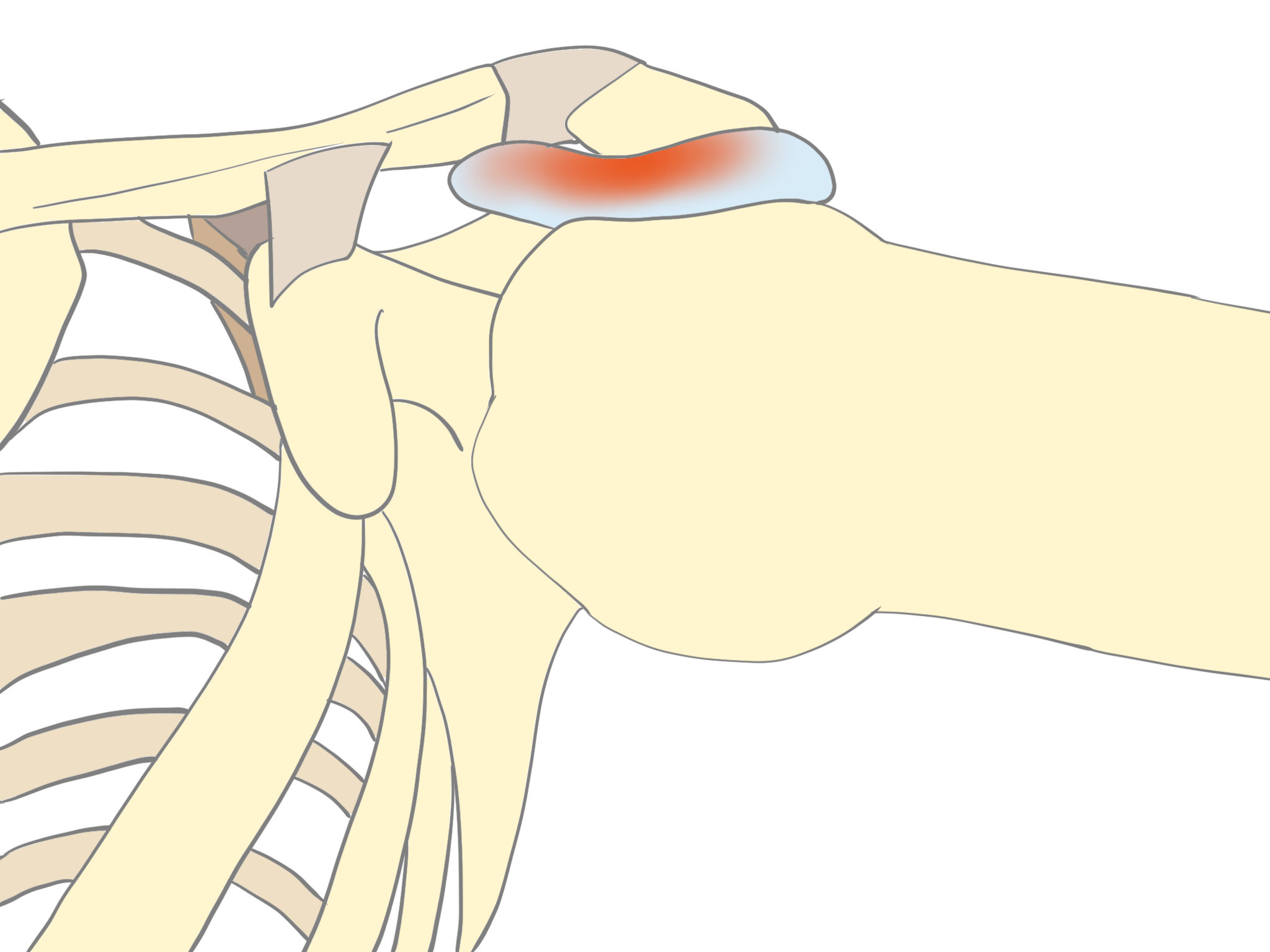 どう違うのでしょうか？