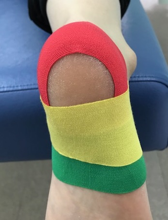 有痛性踵パッドテーピング色付き