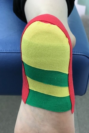 有痛性踵パッドテーピング色付き
