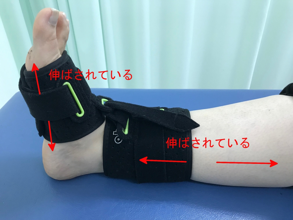 足底腱膜炎 ナイトブレース