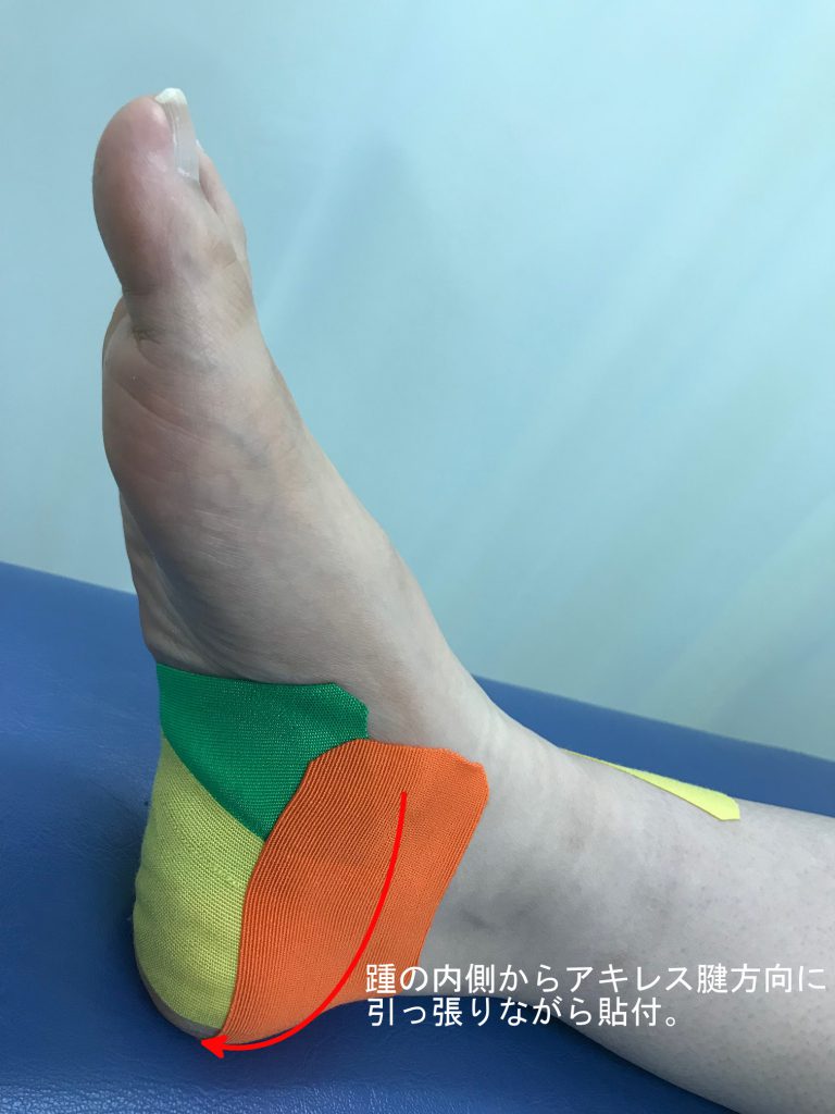 腓骨筋テーピング⑤