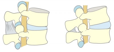 腰部の屈伸による椎間関節の動き