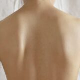 脊柱側弯症の原因や治療法【金沢市アルコット接骨院】