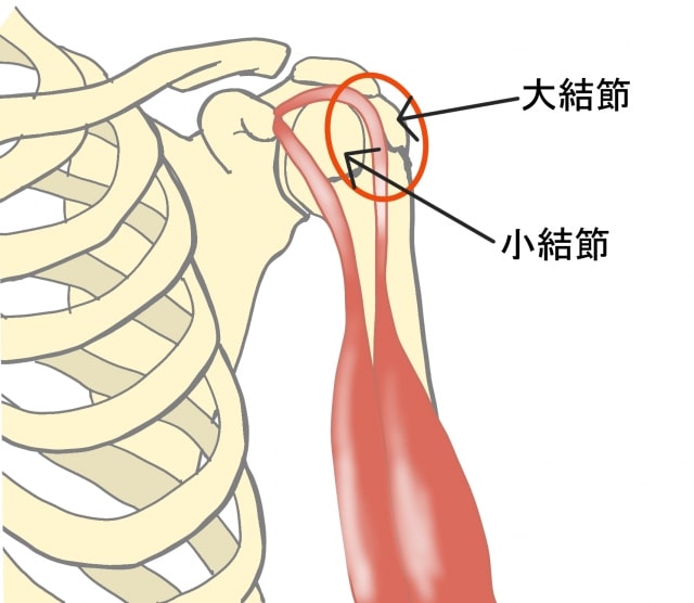 上腕二頭筋長頭腱の摩擦