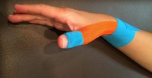 ボウリングによる親指の痛みに対するテーピング