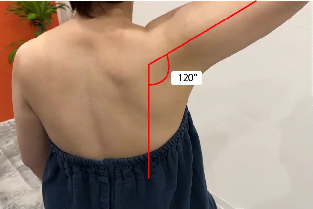 肩甲骨の位置修正テーピング