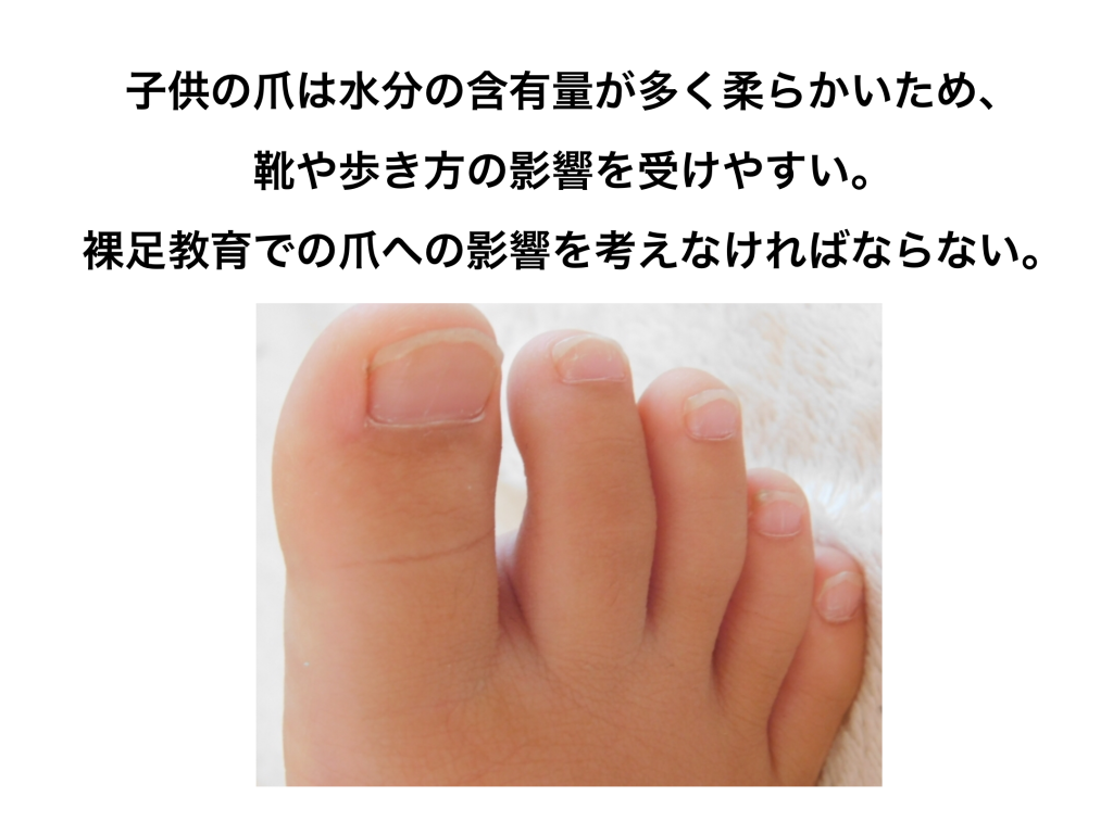 子供の巻き爪