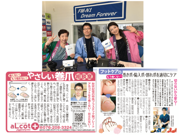 金沢市巻き爪補正