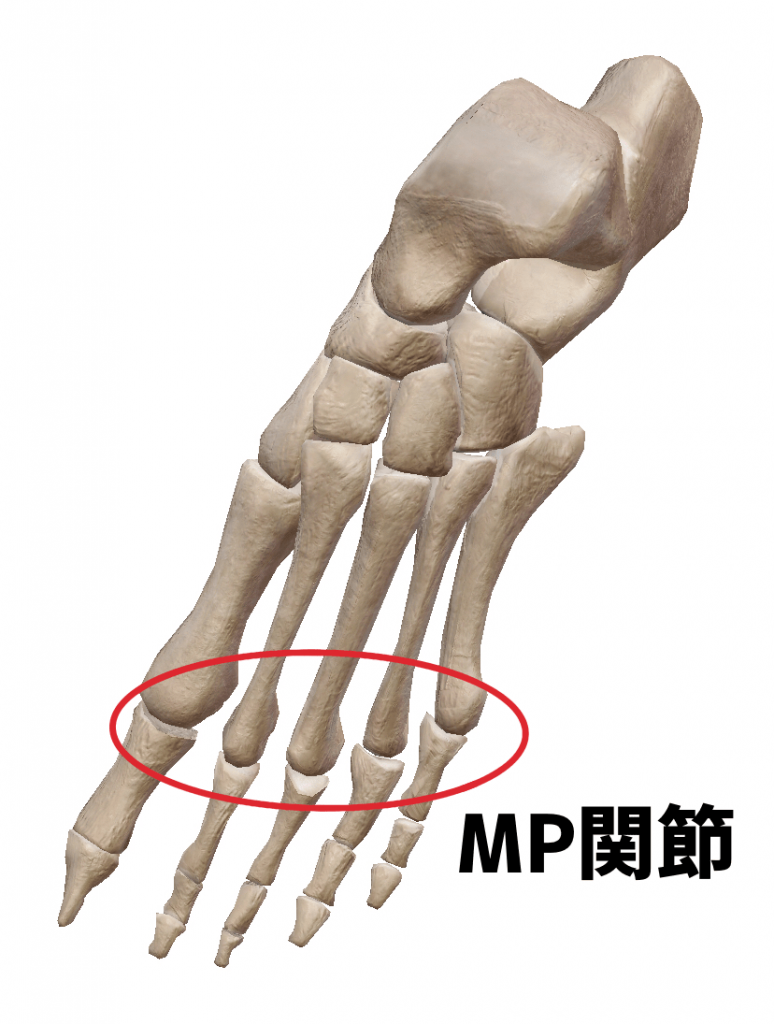 金沢巻き爪 MP関節とは