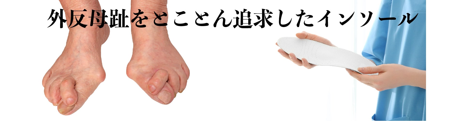外反母趾トップ画像