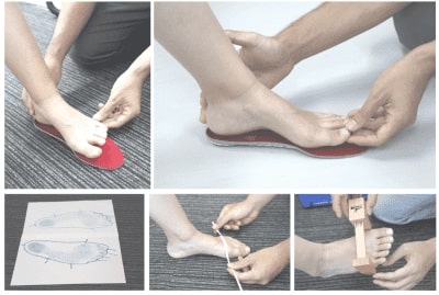 立方体症候群はどのように治療されますか?