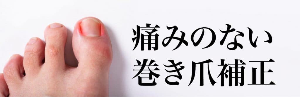 金沢市巻き爪治療