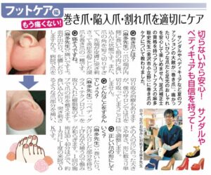 巻き爪リビング金沢掲載