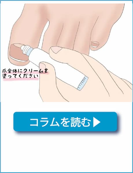 巻き爪の予防法