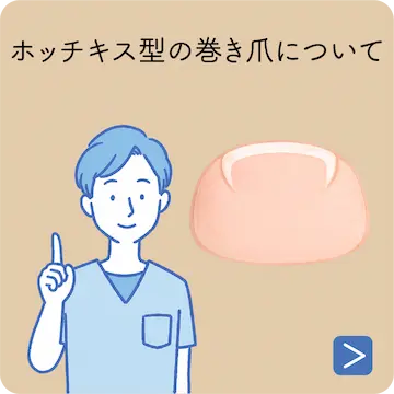 巻き爪と栄養の関係は？