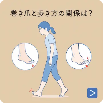 巻き爪と栄養の関係は？