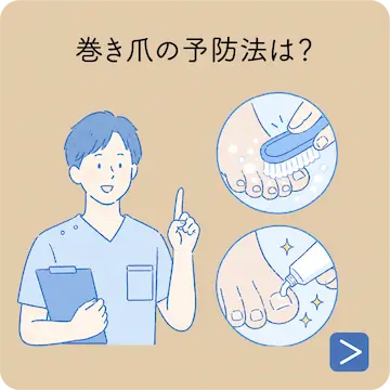 爪を短く切りすぎてしまったら？