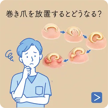 爪を短く切りすぎてしまったら？