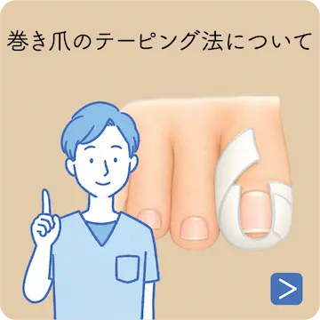 爪を短く切りすぎてしまったら？