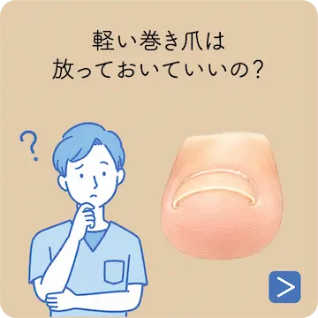 爪を短く切りすぎてしまったら？
