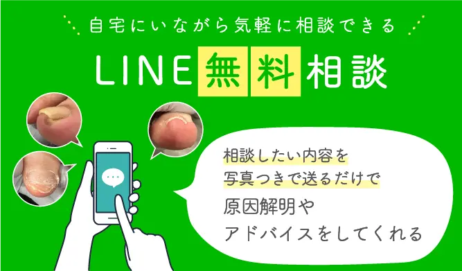 巻き爪治療について問い合わせる (2)