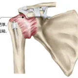 肩関節周囲炎・五十肩の原因や治療法【金沢市アルコット接骨院】