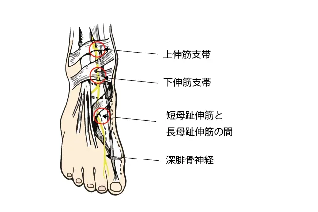 足根管とは