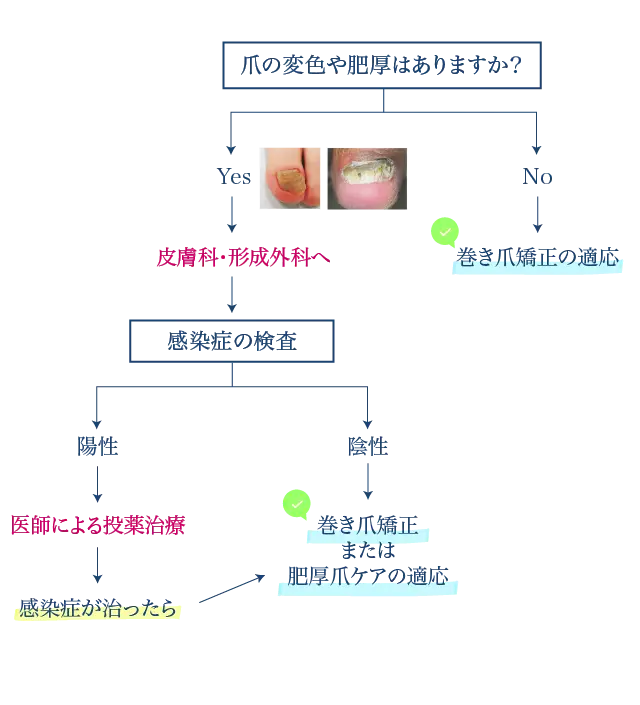 水虫巻き爪チャート
