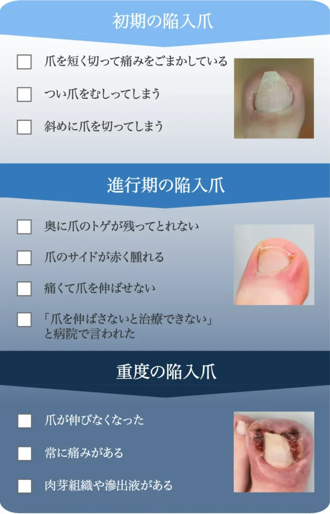 深爪の進行チェック表（クリニック）