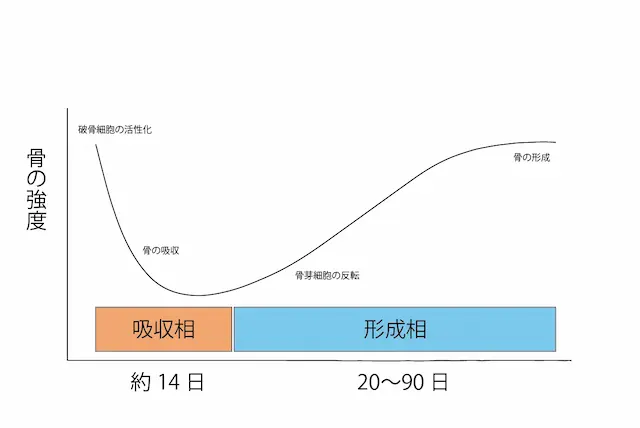 疲労骨折のメカニズム