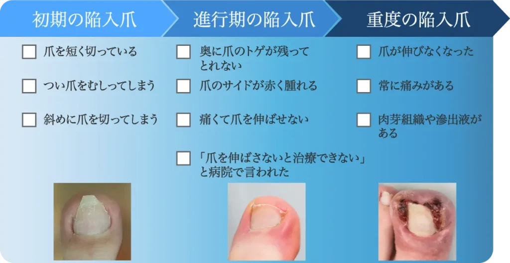 陥入爪進行表（PC)