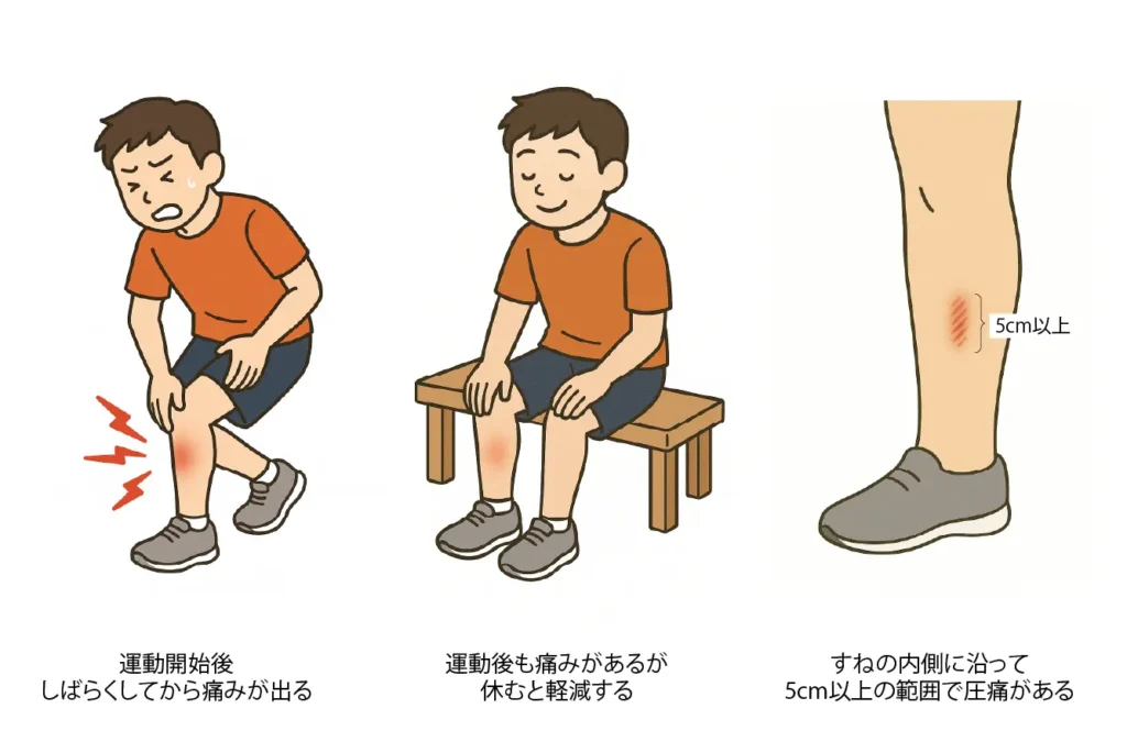 シンスプリントの症状