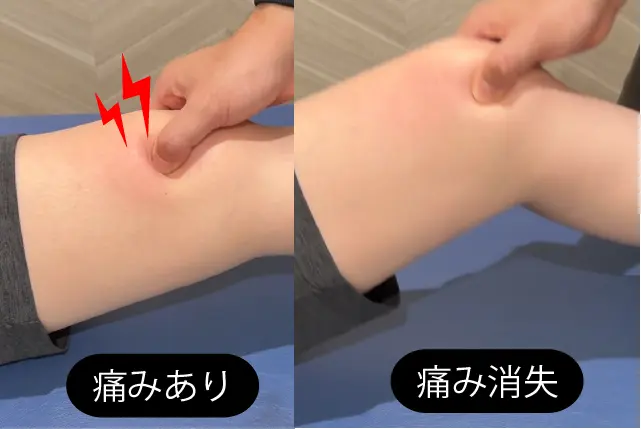 タナ障害検査