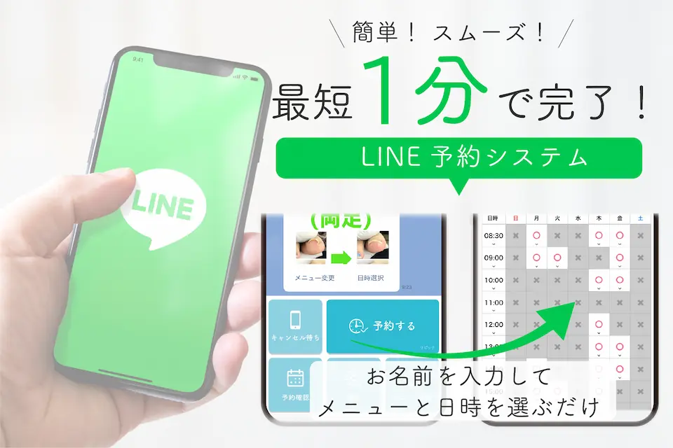 巻き爪LINE予約