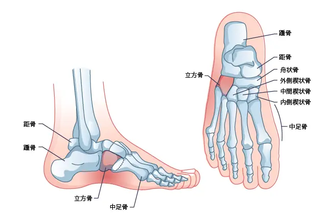 立方骨症候群（解剖学）