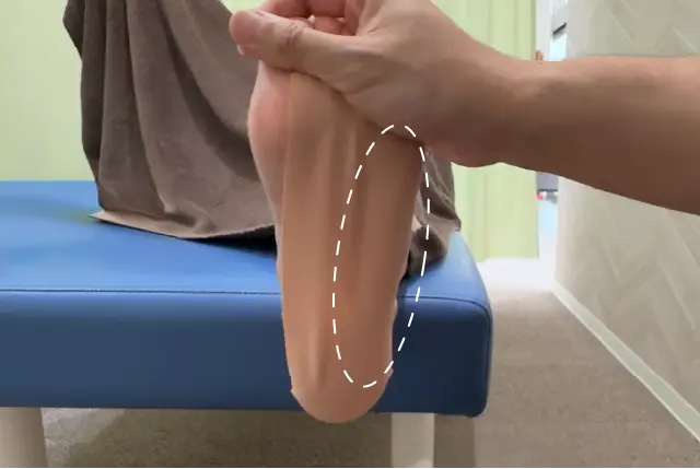キネシオを使ったシンスプリントのテーピング①