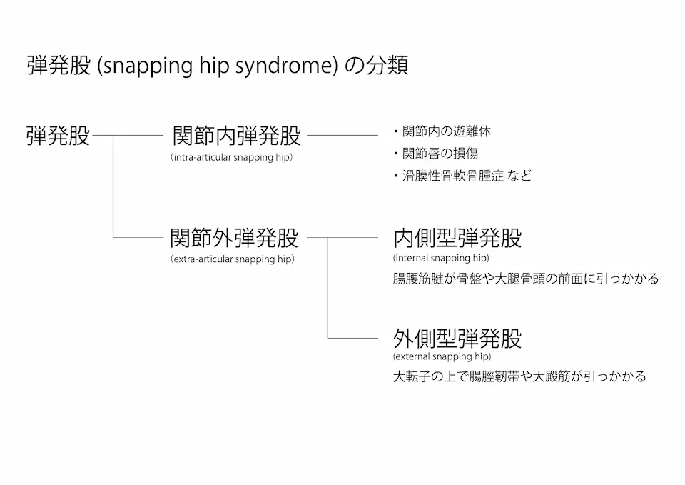 弾発股の分類